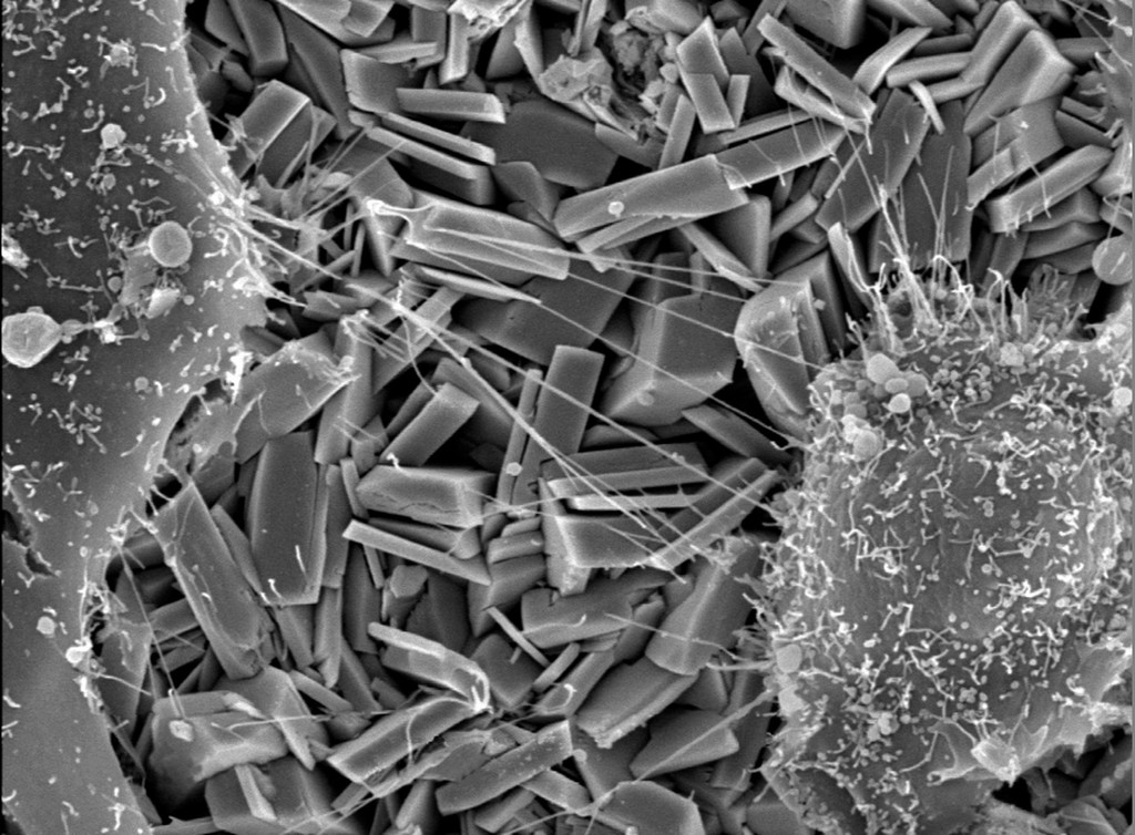 a black and white photo of bone forming cells adhering to the crystalline interface of a prosthetic device