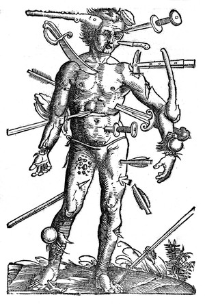 The black and white engraving shows a man standing with various kinds of wounds in his body made by different weapons.